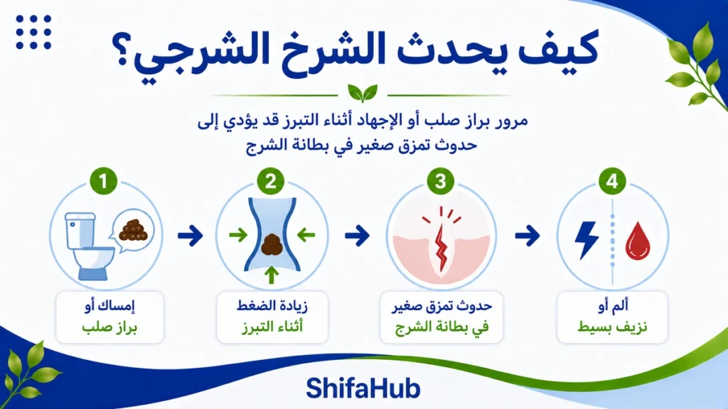 كيف يحدث الشرخ الشرجي؟