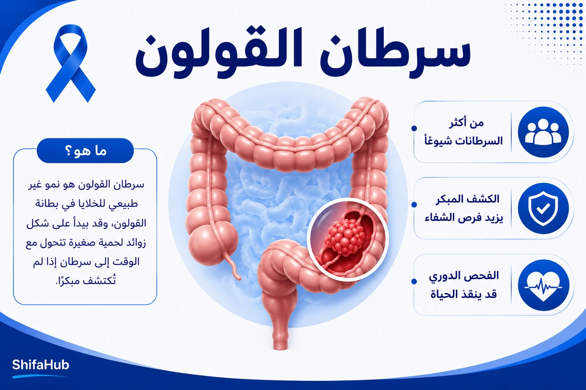أعراض سرطان القولون وعلامات الإنذار المبكر وطرق التشخيص والعلاج