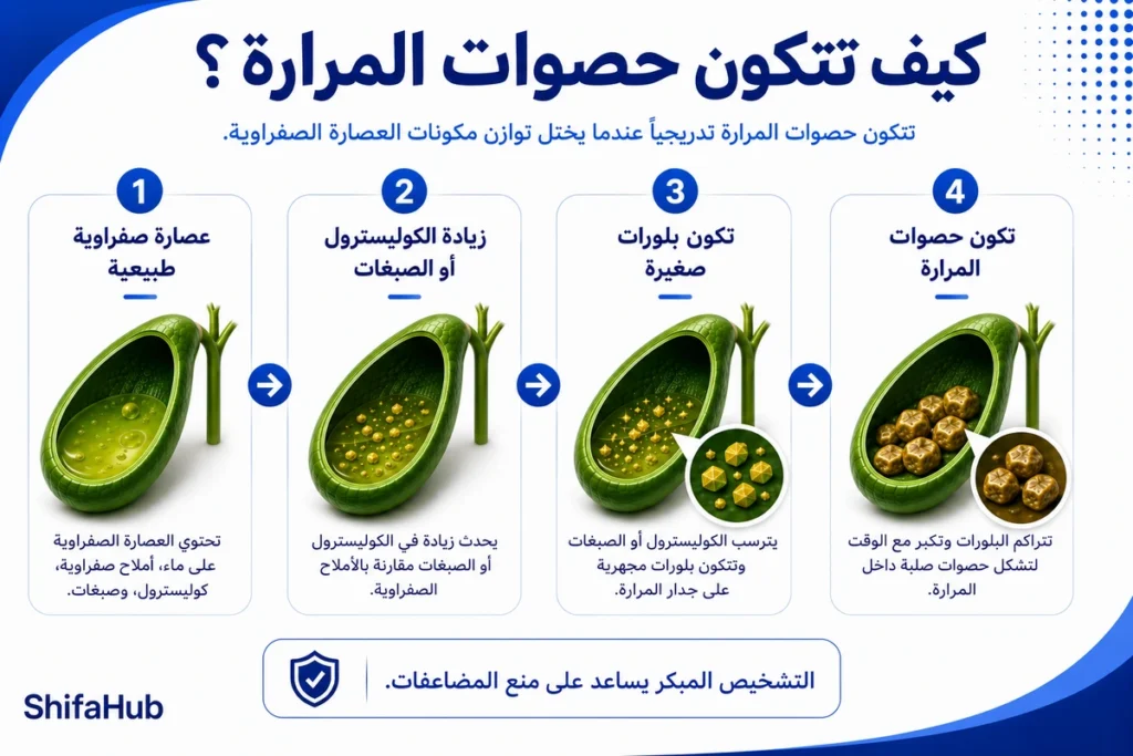 كيف تتكون حصوات المرارة؟