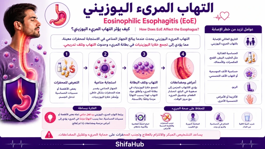 ماهو التهاب المريء اليوزيني؟